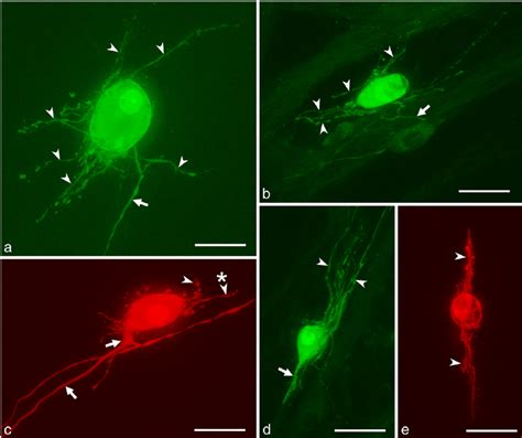 Frog Intracardiac Neurons Of The Multipolar A B And Bipolar C E