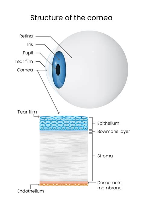 fuchs dystrophy brisbane  eye health centre