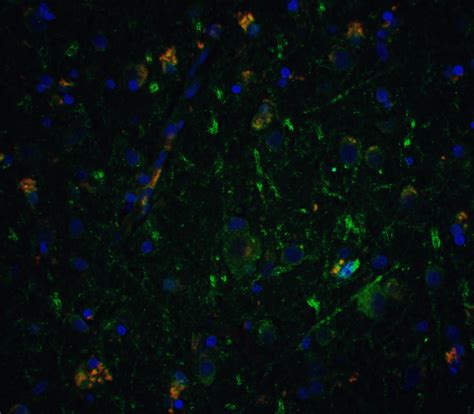 Anti Neurturin Antibody QED Bioscience Inc