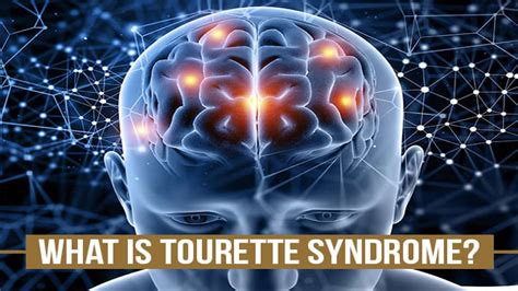 Tourette Syndrom Us