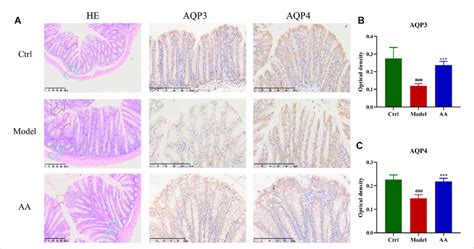 Effect Of Aa On The Colon Structure And Expression Of Aqp And Aqp In