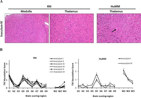 TSE Vacuolation Vacuolation Profiles And PrPSc Deposition In