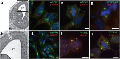 WDR62 Expression In Developing Mouse Brain And Subcellular