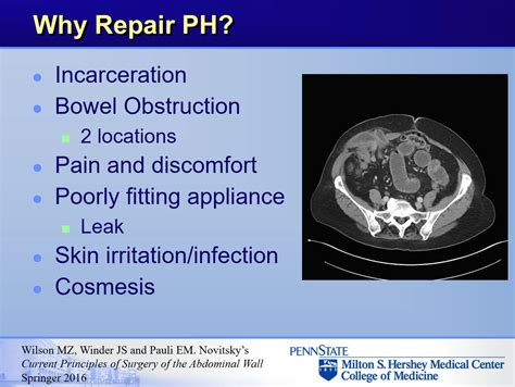 Eric Pauli Parastomal Hernia Repair Techniques On Vimeo