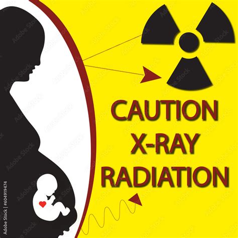 Radiation Hazard Symbol Pregnant Woman Warning Caution X Ray