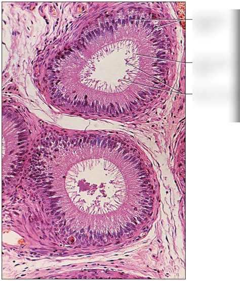 epidymides diagram quizlet
