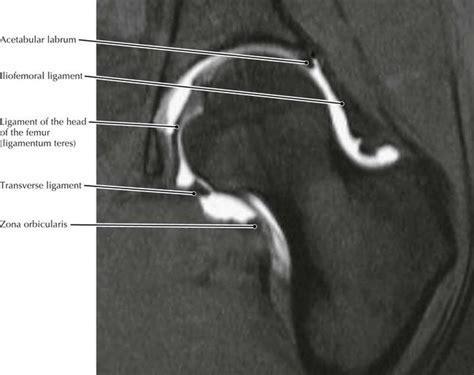 Lower Limb Radiology Key