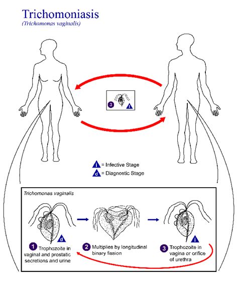 Causes Symptoms And Treatment Options Of Trichomoniasis Disease 99 Health Ideas