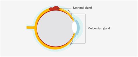 What Is Meibomian Gland Dysfunction Key Symptoms Causes And