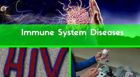 Types and Symptoms of Immune System Diseases | Institute of Ecolonomics