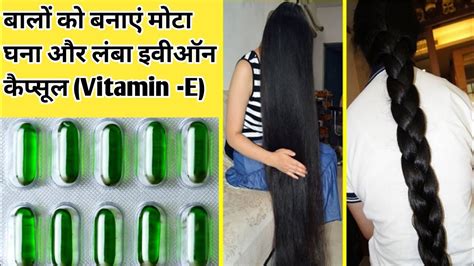 NO HAIRFALL CHALANGE How To Use Vitamin E Capsule For Hair Growth