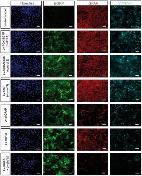 GFAP And Vimentin Levels Were Decreased In Medullar Astrocytes