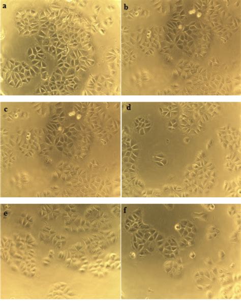 Microscopic Analysis Of Morphological Alterations Of The Mcf 7 Cells In Download Scientific