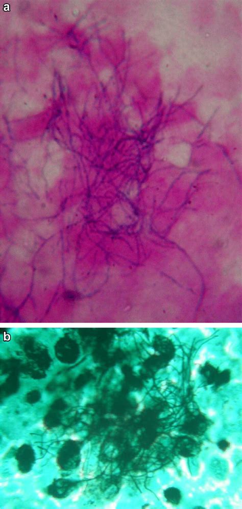 E A Photomicrograph Showing Gram Positive Branching Filamentous Rods