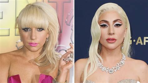 Did Lady Gaga Get Plastic Surgery What She S Said About It Life And Style