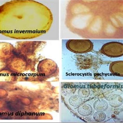 (PDF) Occurrence of VAM fungi in Kalasalingam University campus