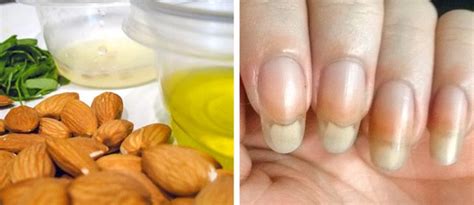 Natural Ways To Fix Your Brittle Weak Nails Bright Side