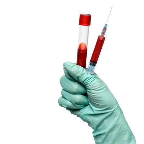 Premium Photo Hand In Latex Glove Holding Blood Sample In Test Tube