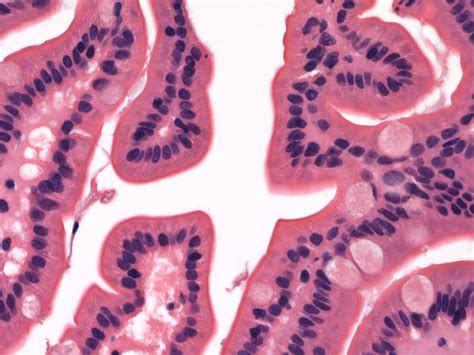 Pathology Outlines - Histology-small intestine