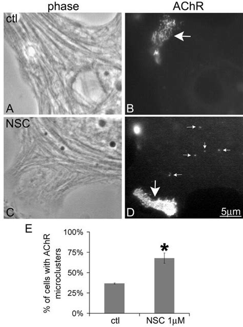 Effect Of Shp Inhibitor Nsc On Achr Micro Cluster Formation