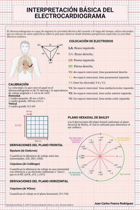 Interpretaci N B Sica Del Electrocardiograma Escuela Ciencias De La Salud