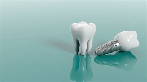 Tooth Implant