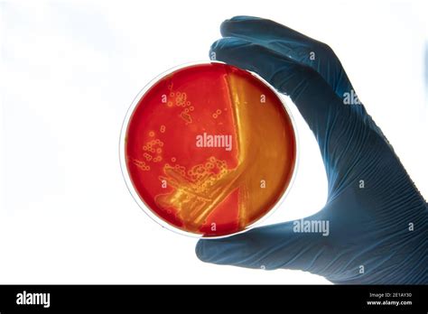 Growing Bacteria In Agar Medium In Microbiology Lab Making Streak In A