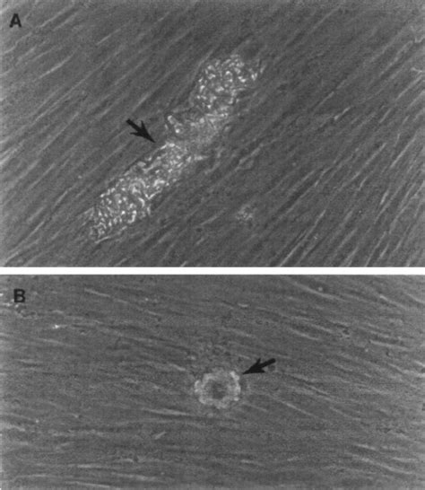 M Abscessus Variants Form Distinctive Microcolonies In The