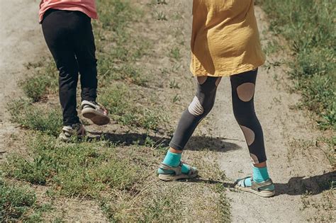 Treatment for Knock Knees - Bone Island Children's Clinic