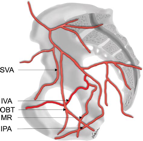 Prostatic Artery Embolization Indications Preparation Techniques