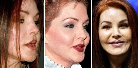 Priscilla Presley Before and After Plastic Surgery: in her youth and now