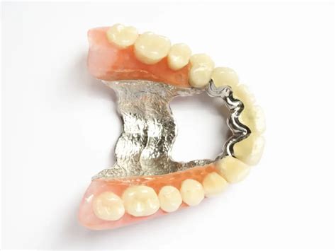 Chrome Dentures Arc Dental Surgery