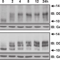 Cellular Localization Of Ddr Isoforms Hek Cells Expressing The