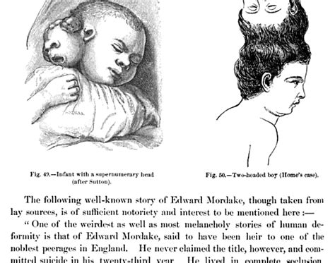 Edward Mordrake, Anomalies and Curiosities of Medicine, 1901 – The Year ...