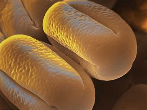 Pollens Les Ennemis Des Allergiques Au Microscope Sciences Et Avenir