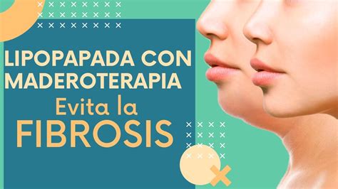 Lipopapada SIN CIRUGÍA para evitar la FIBROSIS YouTube