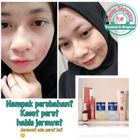 yanko skincare original