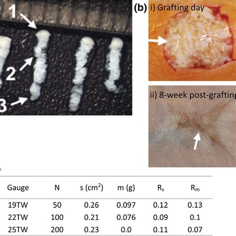 Skin Biopsy Is The Current Standard For Skin Conditions Diagnosis The