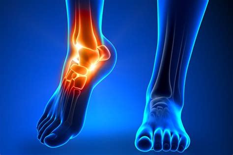 Nerves May Cause Foot Pain? – Corrigan Podiatry