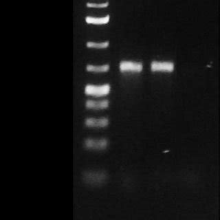 Rflp Pattern For Invasive Bivalves Lane Bp Plus Dna Ladder Rtu