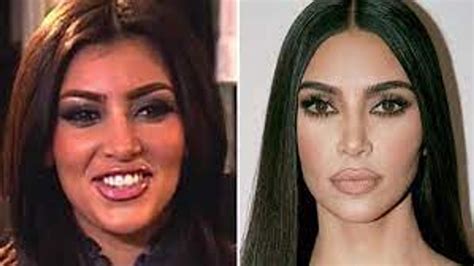 Does Kim Kardashian Have Filler In Her Face? | Glowday