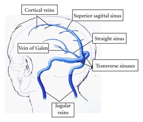 The major venous sinuses and their tributaries. | Download Scientific Diagram