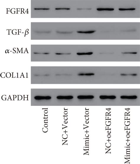 Fgfr4 Overexpression Inhibited The Proliferation And Activation Of Lx 2