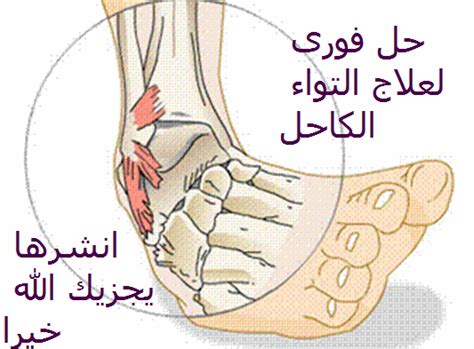 علاج التواء الكاحل بالصور دموع جذابة