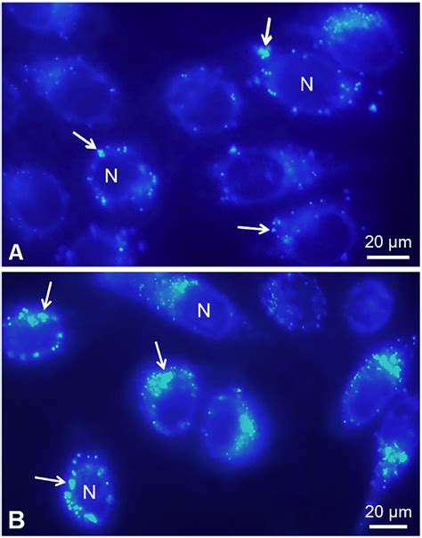 Fluorescence Micrographs Of Cultured Lm2 Cells A And Igrov 1 Cells