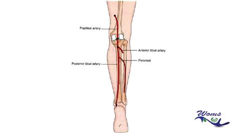 Posterior tibial pulse - ladervp