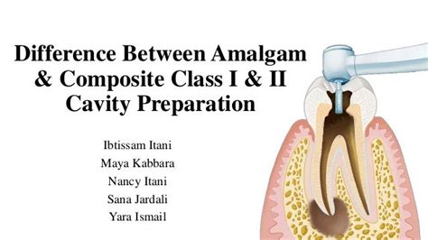 Amalgam Vs. Composite Amalgam Composite Decision - bandacruise