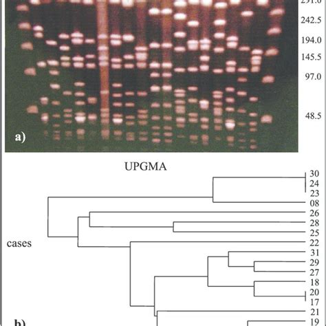 Pfge Profiles Of Smai Digested Genomic Dna Of Staphylococcus Aureus