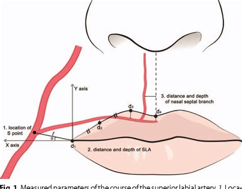 Topographic anatomy of the superior labial artery for dermal filler ...