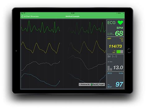 SciChart IOS Android Xamarin V2 Released SciChart